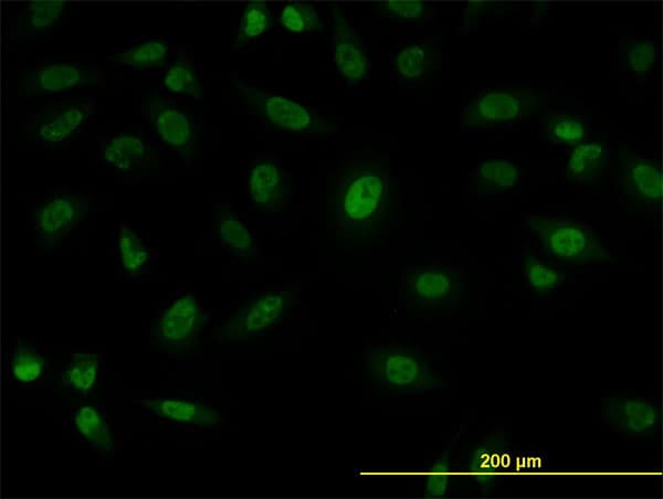 IHC-plus™ Monoclonal Mouse anti-Human SFPQ Antibody (clone 6D7, IHC, IF, WB)