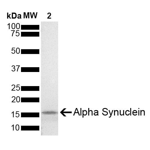 Mouse SNCA / Alpha-Synuclein Protein (Recombinant)