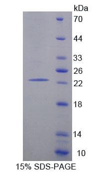 Human AGO1 / EIF2C Protein (Recombinant His-T7, N-terminus)