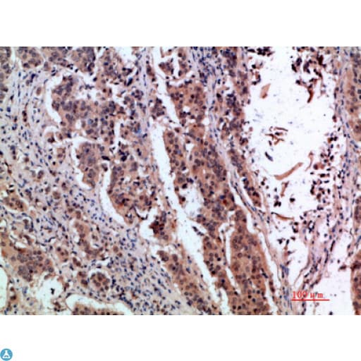 TFF1 / pS2 Antibody
