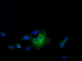 Monoclonal Mouse anti-Human TS / Thromboxane Synthase Antibody (clone OTI1A9, IHC, IF, WB)