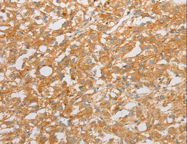 NGF Antibody