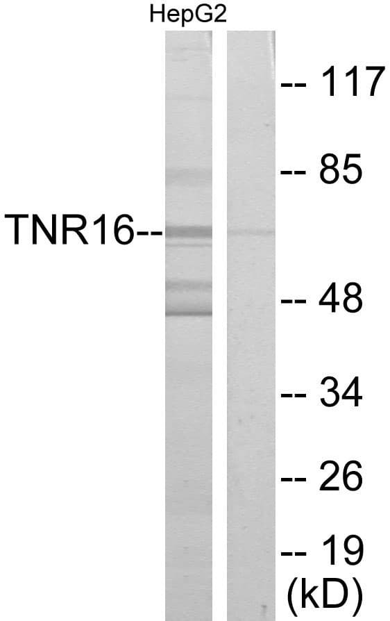 NGFR / CD271 / TNR16 Antibody (aa121-170)
