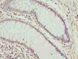CPXCR1 / CT77 Antibody