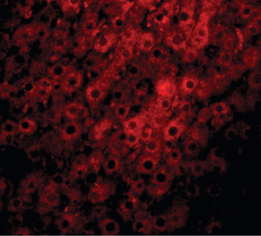 IHC-plus™ Polyclonal Rabbit anti-Human JMJD1C Antibody (IHC, IF, WB)