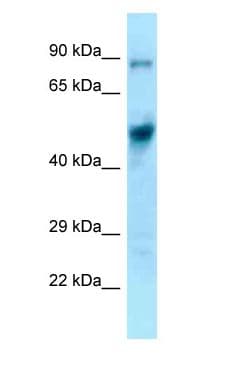 EIF4A1 Antibody (aa275-324)