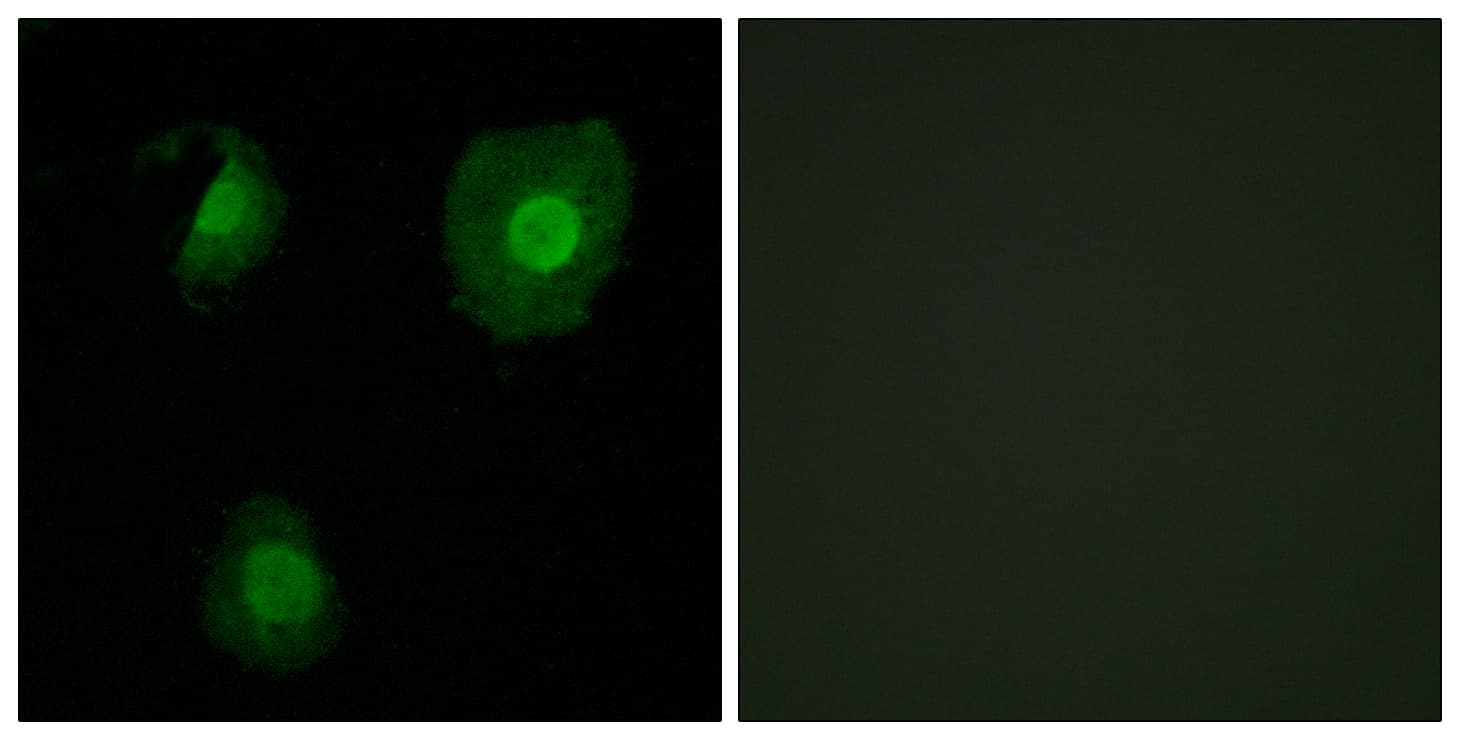 Polyclonal Rabbit anti-Human EID1 / EID-1 Antibody (aa71-120, IF, WB)
