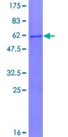 Human CMAS Protein (Recombinant GST)