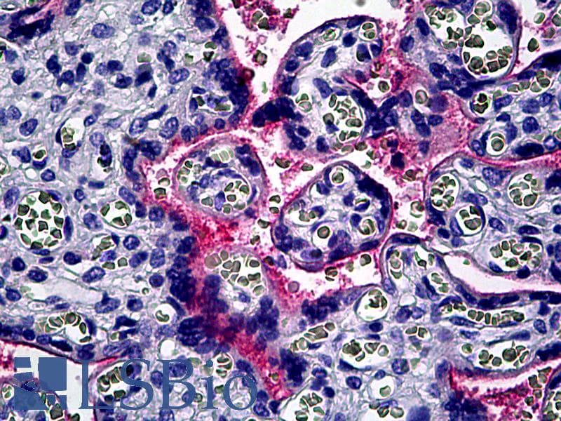IHC-plus™ Polyclonal Rabbit anti-Human ITGAV/Integrin Alpha V/CD51 Antibody (aa840-889, IHC, WB)