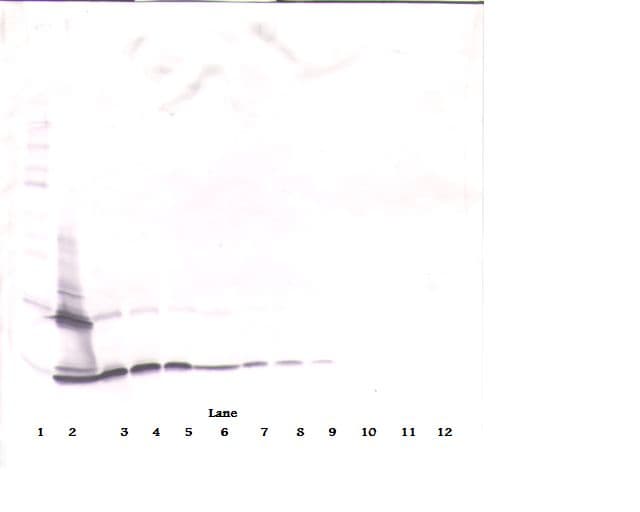 PDGF-BB Antibody