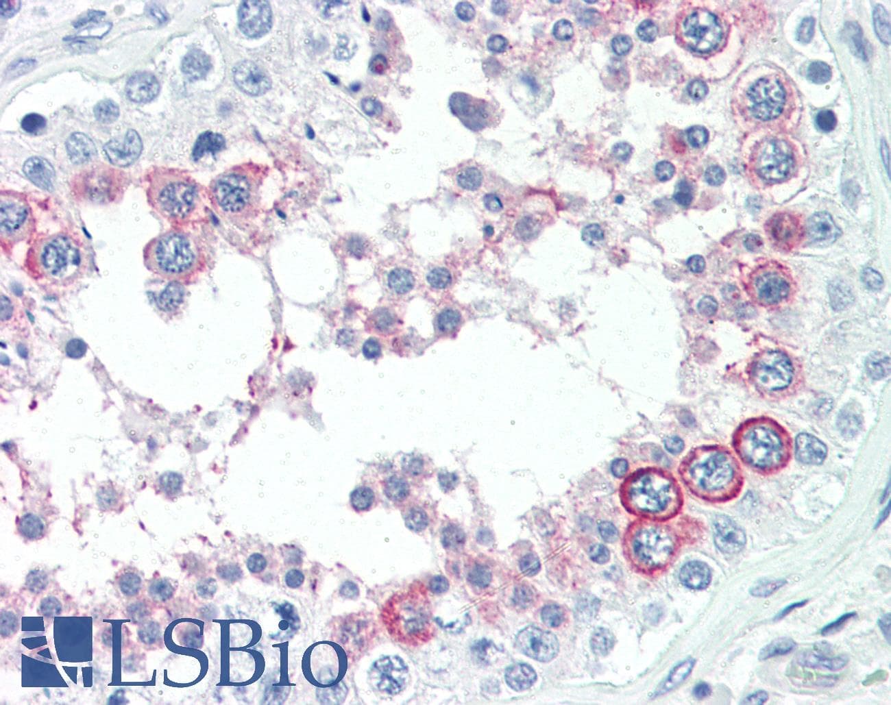 PathPlus™ NANOG Antibody (aa94-123)