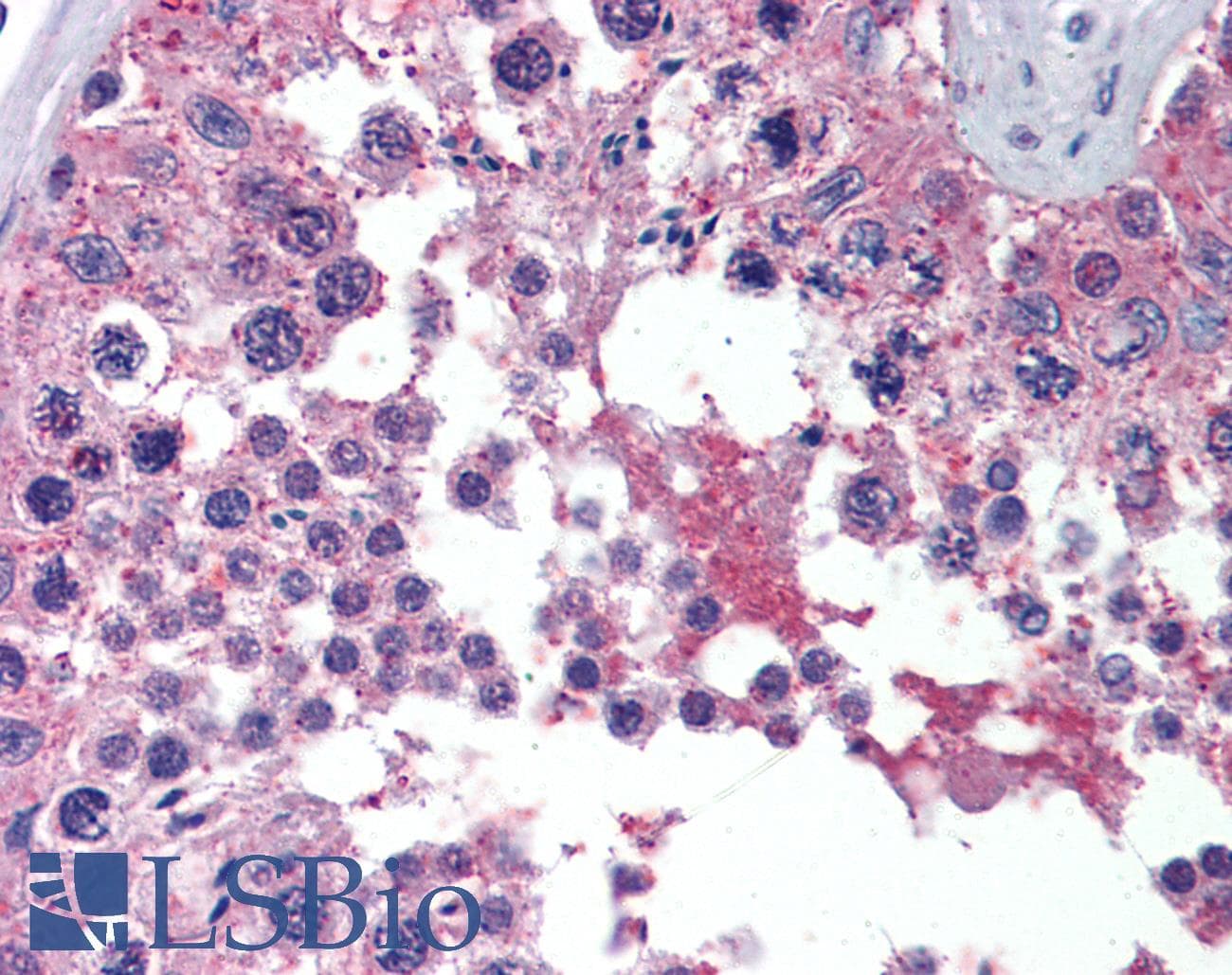 PathPlus™ BRAF / B-Raf Antibody (clone 1H12)