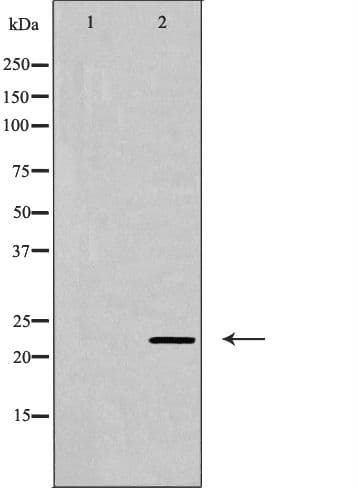 CLDN6 / Claudin 6 Antibody