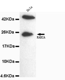 RAB2A / RAB2 Antibody (C-Terminus)