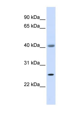 Polyclonal Rabbit anti-Human ADA / Adenosine Deaminase Antibody (aa288-337, IHC, WB)