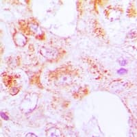 CETN3 Antibody