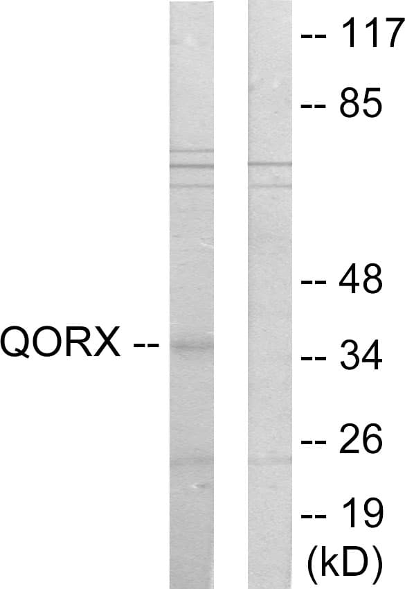 TP53I3 / PIG3 Antibody (aa241-290)
