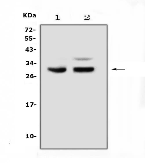 Polyclonal Rabbit anti-Human PDCD10 Antibody (WB)