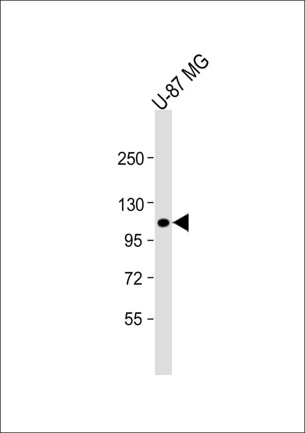 Polyclonal Rabbit anti-Human ITGB3 / Integrin Beta 3 / CD61 Antibody (WB)