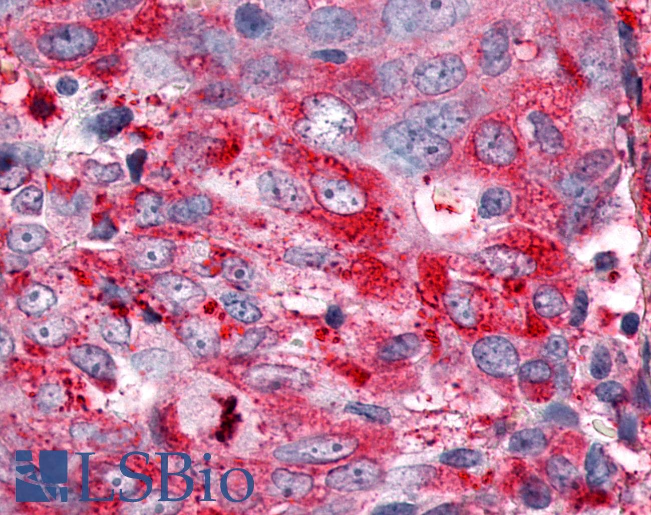 PathPlus™ Polyclonal Rabbit anti-Human ESRRG / ERR Gamma Antibody (C-Terminus, IHC, WB)