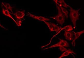 Polyclonal Rabbit anti-Human SERPINB4 / SCCA1+2 Antibody (IF, WB)