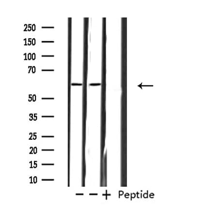 Polyclonal Rabbit anti-Human ZNF695 Antibody (IF, WB)