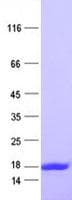 Human GEMIN7 Protein (Recombinant His, N-Terminal)