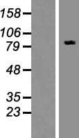 FBXO30 Protein (Over-Expression Lysate Myc-DDK (Flag))