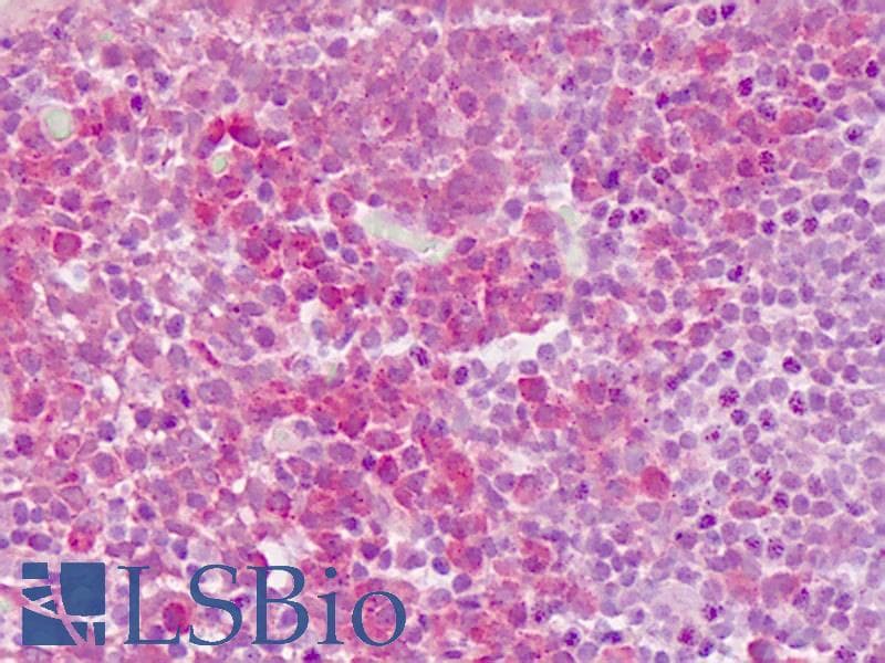 IHC-plus™ PDGFRA / PDGFR Alpha Antibody (Tyr768)