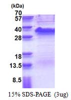 Human SSR1 Protein (Recombinant His)