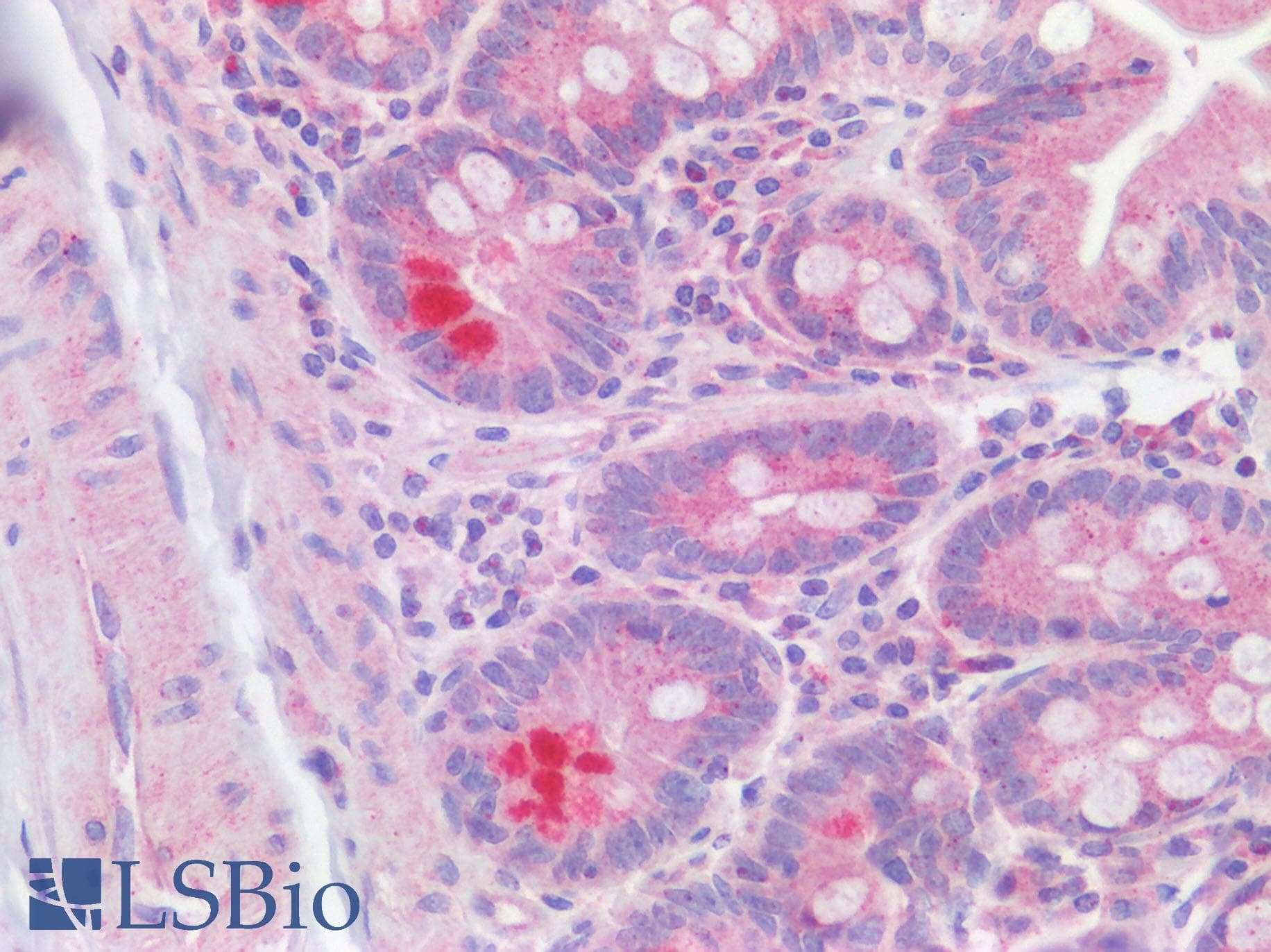 ATOH1 / MATH-1 Antibody