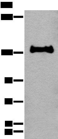 CAPN15 / SOLH Antibody