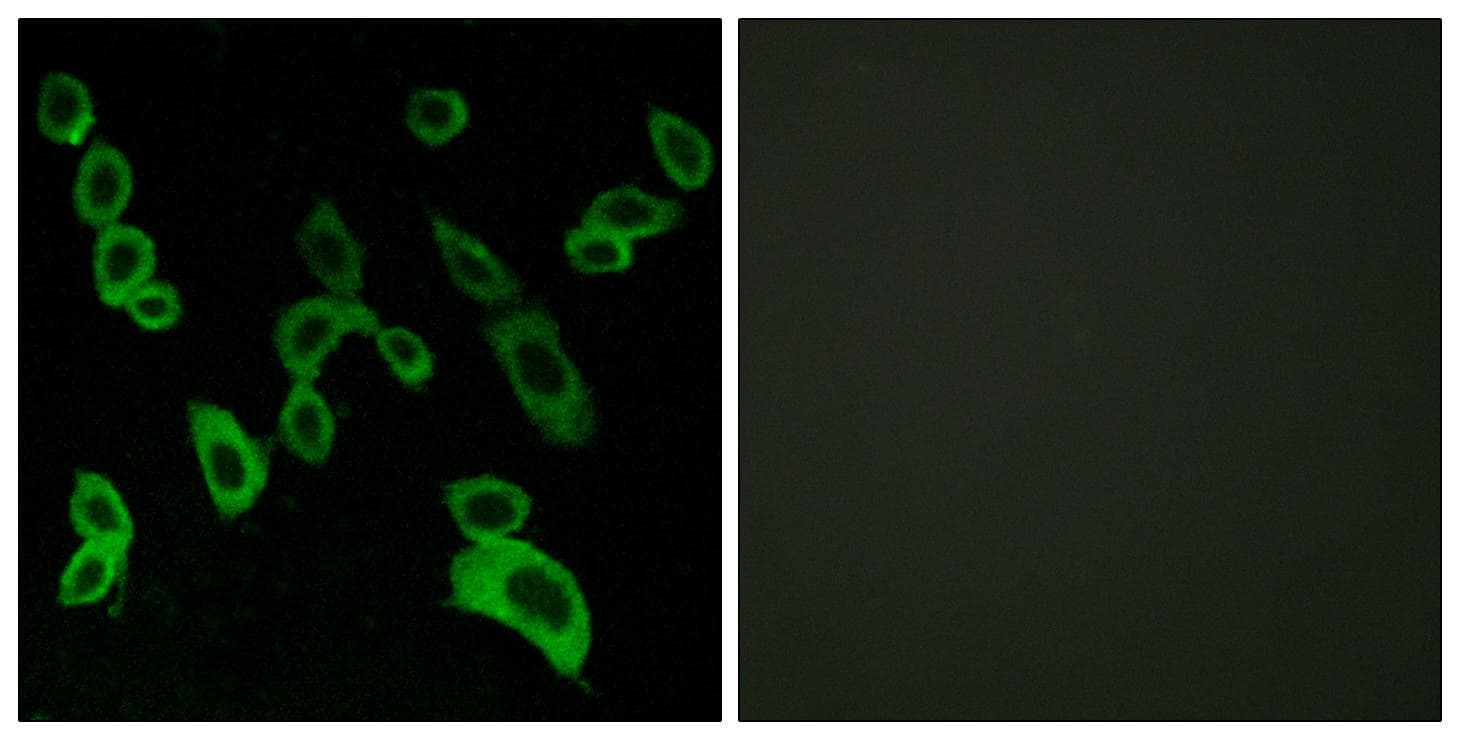 Polyclonal Rabbit anti-Human GPR139 Antibody (IF)