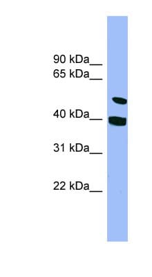 FSAP57 / SMU1 Antibody (aa107-156)