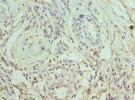SLAMF7 / CRACC Antibody (aa23-226)