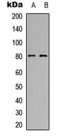 MTA1 Antibody (Internal)