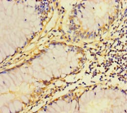Polyclonal Rabbit anti-Human ZDHHC15 Antibody