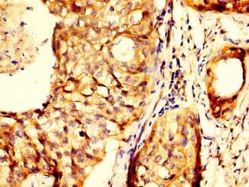 Polyclonal Rabbit anti-Human RHCG Antibody (IHC, WB)