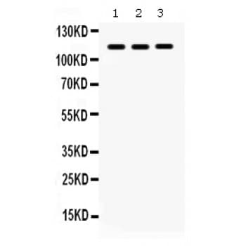 ITGA2B / CD41 Antibody (aa677-711)