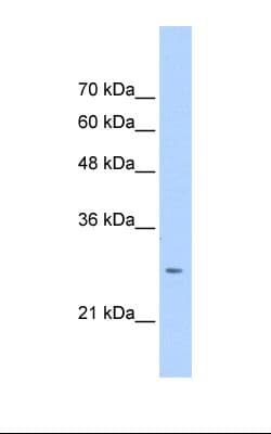 Polyclonal Rabbit anti-Human Junctin / ASPH Antibody (N-Terminus, WB)