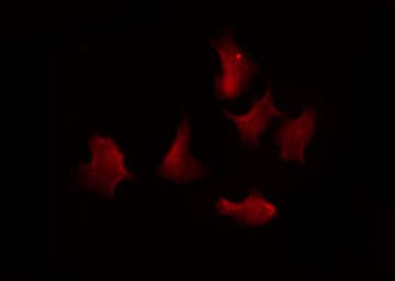 SMAD1 Antibody