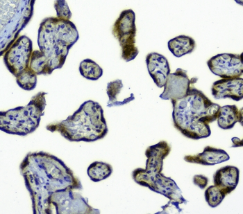 Polyclonal Rabbit anti-Human SIRT4 / Sirtuin 4 Antibody (IHC, WB)