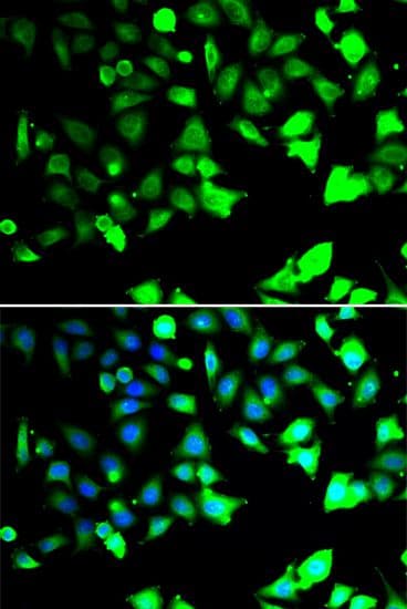 XIAP Antibody