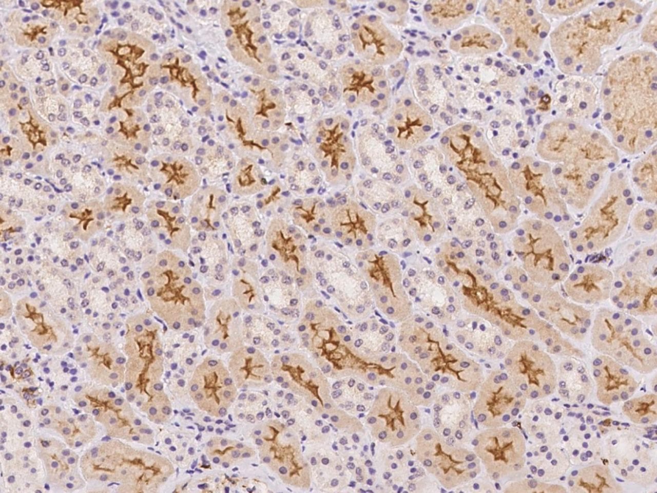 IL15RA Antibody