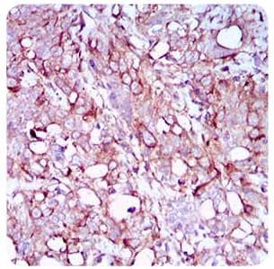 SYCP3 / SCP3 Antibody (aa1-200, clone 6F9C5)