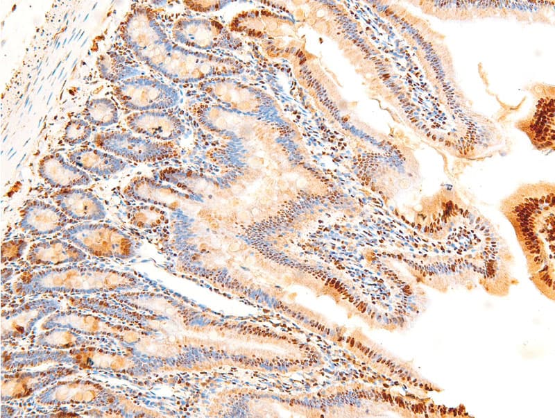 JUN / c-Jun Antibody (phospho-Ser243)