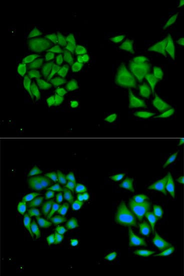 Polyclonal Rabbit anti-Human DDX58 / RIG-1 / RIG-I Antibody (IHC, IF, WB)