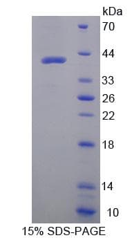 Rabbit Osteocalcin Protein (Recombinant His-GST-S)