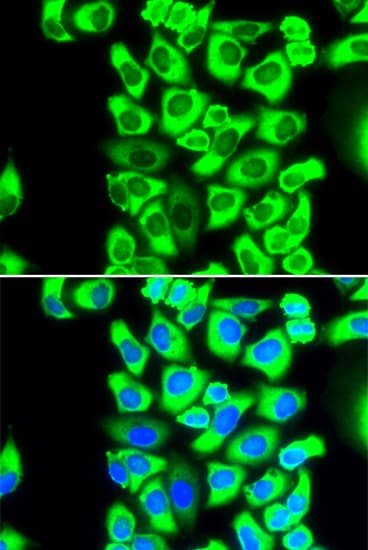 RPS3A / Ribosomal Protein S3A Antibody