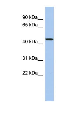PDCD7 Antibody (N-Terminus)